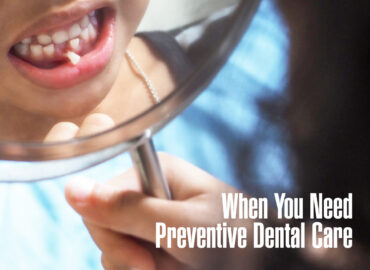 When-You-Need-Preventive-Dental-Care